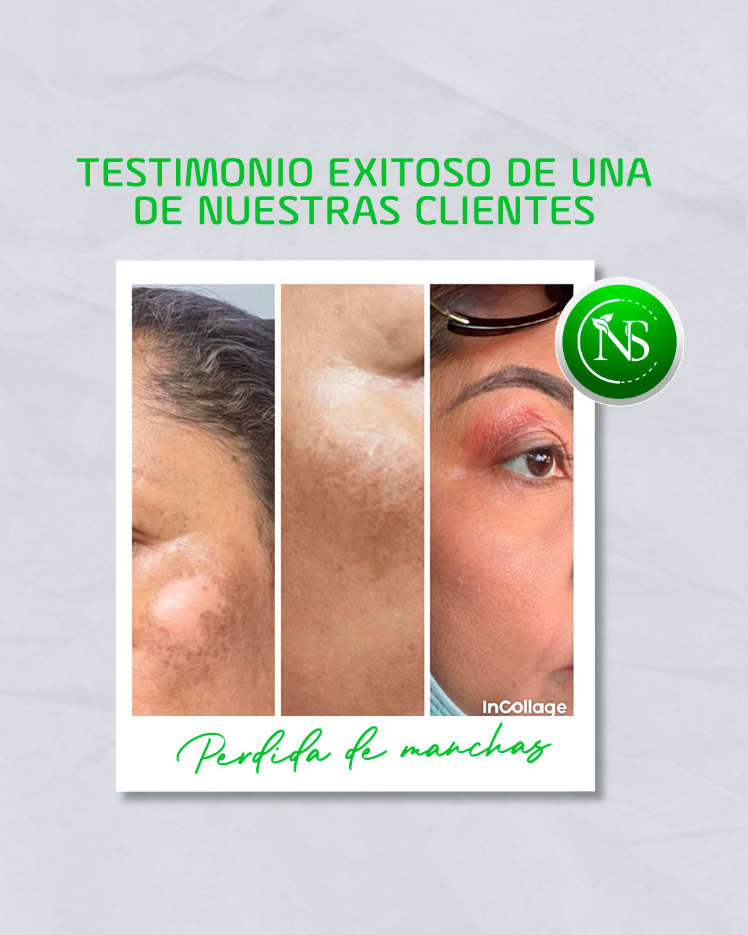 Resultado antes y después